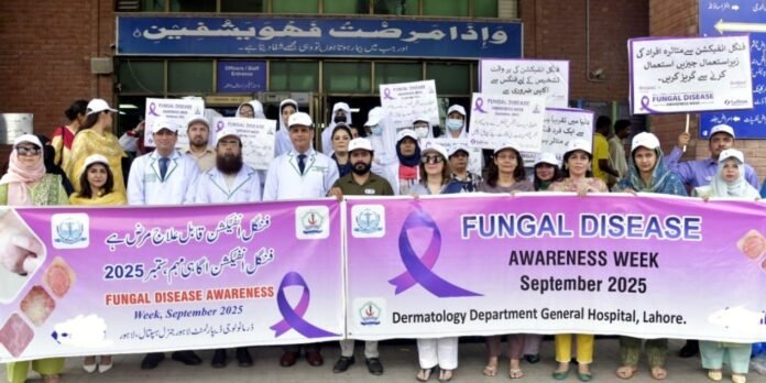 The picture shows participants of fungal diseases awareness walk-LGH