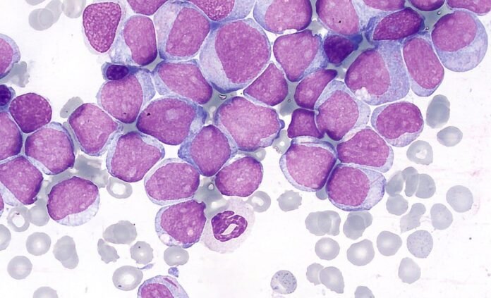 The picture shows microscopic view of blood cells-UHS